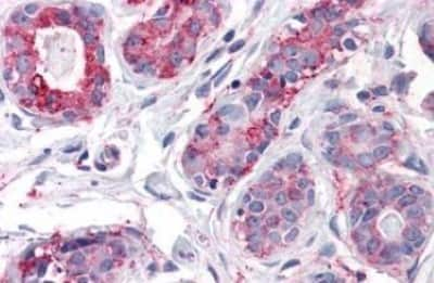 Immunohistochemistry-Paraffin: CD39L1/ENTPD2 Antibody [NBP3-14293]